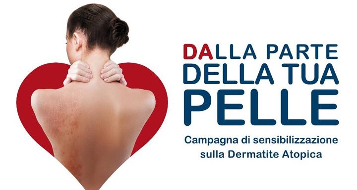 A Salerno colloqui gratuiti sulla dermatite atopica