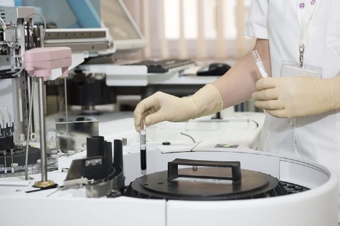 coronavirus, salerno, sala consilina vallo di diano costiera