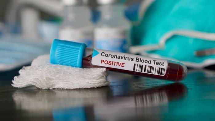 Coronavirus, situazione attuale: nel salernitano 652 positivi