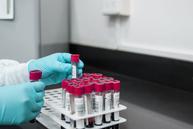 Covid-19: al via i test sierologici nei laboratori privati in Campania