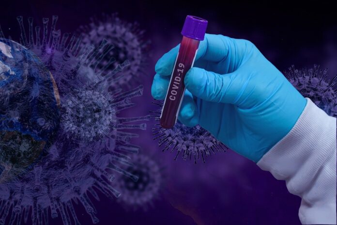 Coronavirus Campania Il Bollettino Di Oggi 28 Ottobre 2020 Zerottonove It Coronavirus Campania Il Bollettino Di Oggi 28 Ottobre 2020 Zerottonove It